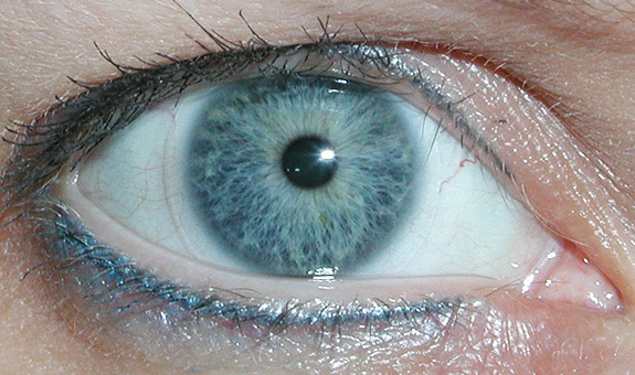 Anpassung von Spezialkontaktlinsen, Altersweitsicht, farbige Linsen, formstabile Kontaktlinsen