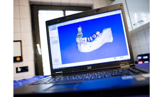 Verschiedene Behandlungen mit 3D-Animationen