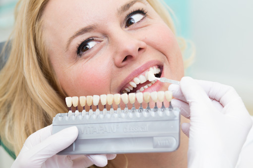 Wir machen Ihre Zähne weißer durch eine ästhetische Zahnaufhellung.