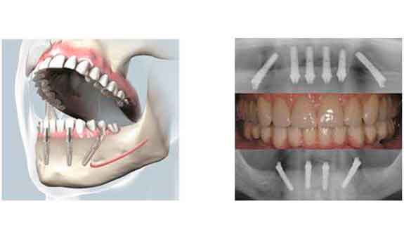Unser Behandlungsspektrum deckt die große Bandbreite der modernen Zahnheilkunde ab