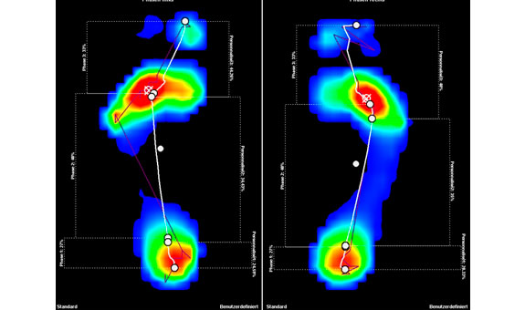 Besonders für Sportler oder Gesundheitsbewusste, aber auch in der Rekonvaleszenz wird durch eine Gang- und Laufanalyse ein Optimum
an gesund erhaltender und -verbessernder sowie leistungsorientierter
Kontrolle der Bewegungsabläufe erreicht.