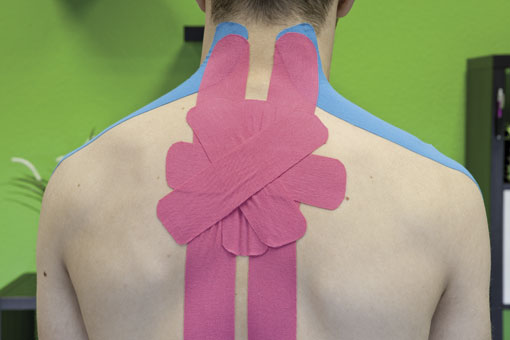 Kinesio-Tape