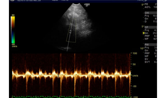 In unserer Praxis führen wir qualifiziertes Herzultraschall (Echokardiographie mit Doppler-Untersuchung), EKG und Blutdruckmessungen durch