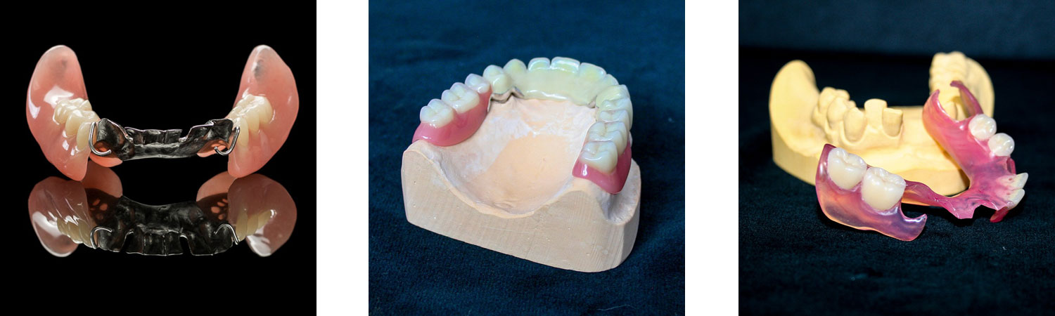 Röder-Dental-Keramik GmbH in Sande - Teil- und Vollprothesen Röder-Dental-Keramik GmbH in Sande - Teil- und Vollprothesen