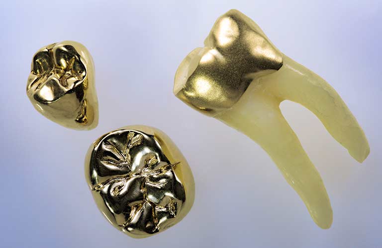 Bild 11 EliteGold in Warendorf