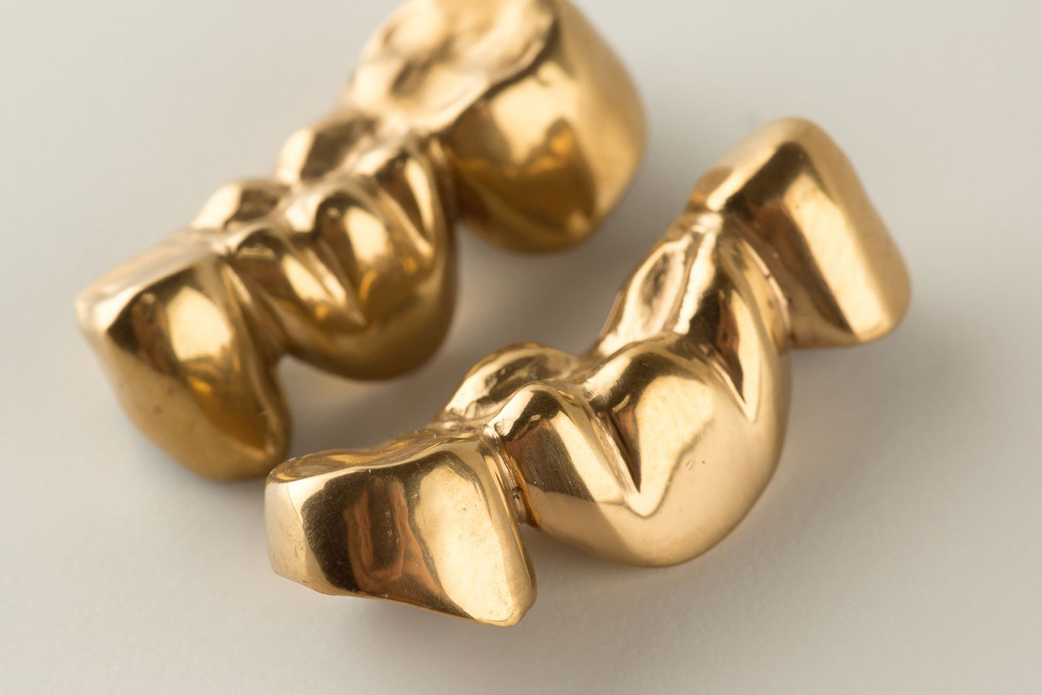 Zahngold