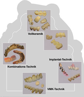 Ästhetischer Zahnersatz auf höchstem Niveau