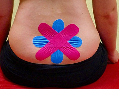 Mit dem Kinesiologie Tape wird der Rücken stabilisiert, ohne dass Sie viel Bewegungsfreiheit einbüßen. Mit dem Kinesiologie Tape wird der Rücken stabilisiert, ohne dass Sie viel Bewegungsfreiheit einbüßen.