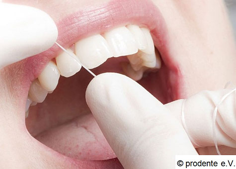 Wenn Ihre Zähne gesund sind, können wir mit unserem Prophylaxe-Programm dafür sorgen, dass dies ein Leben lang so bleibt. Sollte eine bestimmte Therapie zur Wiederherstellung Ihrer Zahngesundheit notwendig sein, bereiten wir Sie durch die Prophylaxe darauf vor. Was zählt, ist der dauerhafte Erfolg!